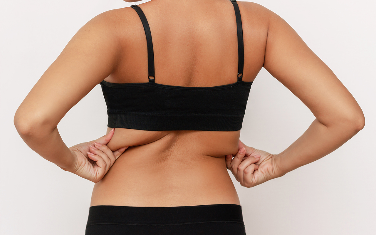 Get Rid of Love Handles Without Surgery