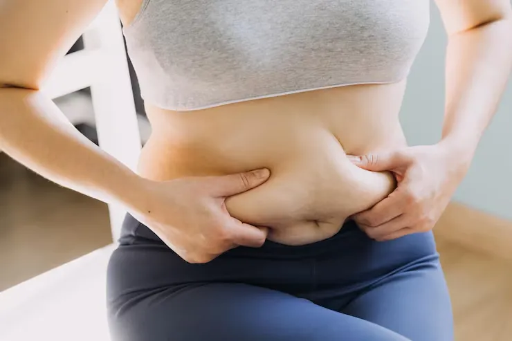 How to Get Rid of Stubborn Fat Without Surgery