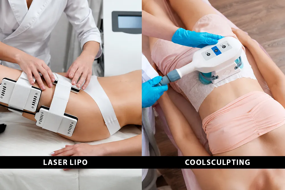 Laser Lipo vs CoolSculpting: Which Option Makes More Sense?