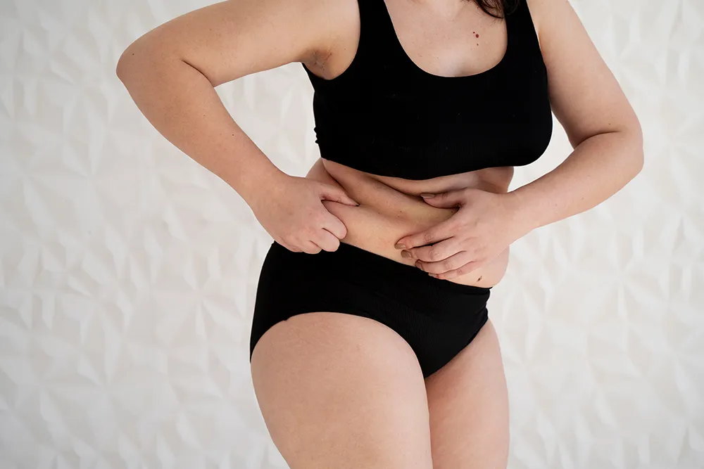 Does Laser Lipo Actually Work for Fat Reduction?