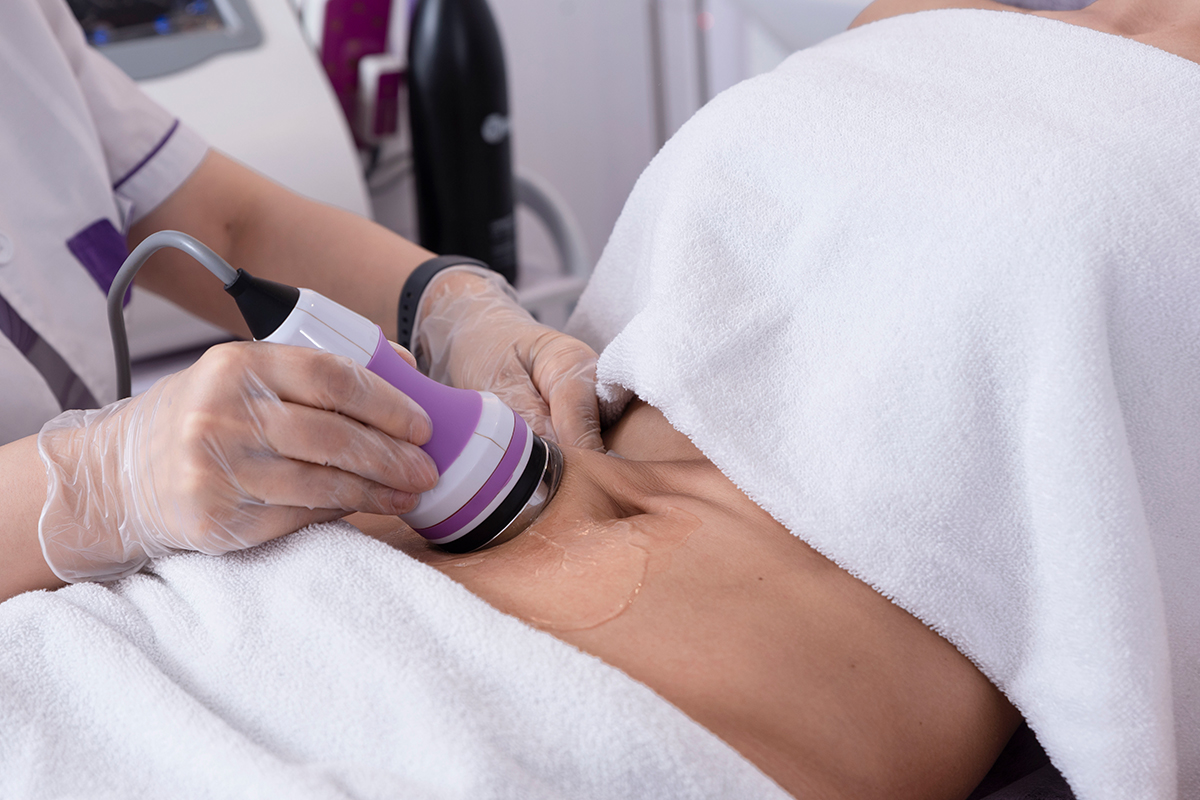 can ultrasonic cavitation cause blood clots