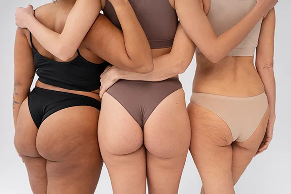 Who Is a Good Candidate for a Vacuum Butt Lift?